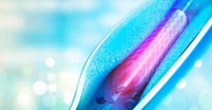 Ultra-thin wire-based stent engineered by Luma Wire Tech, designed for precise deployment in delicate blood vessels during minimally invasive procedures.